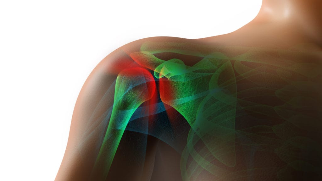 Rotator Cuff
