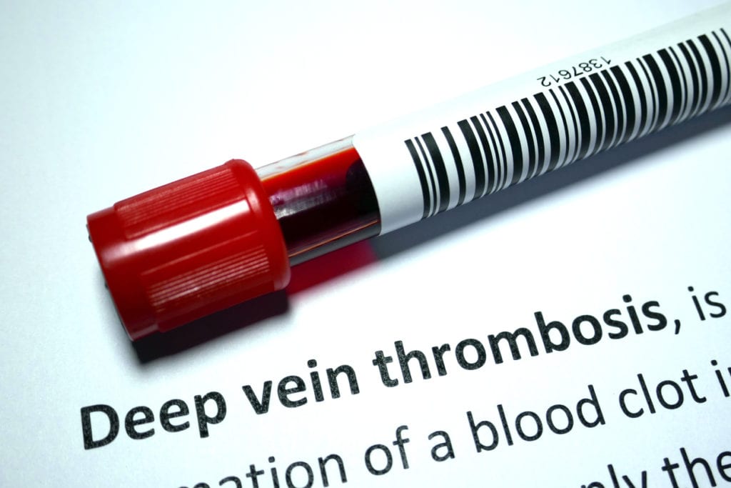 Deep Vein Thrombosis