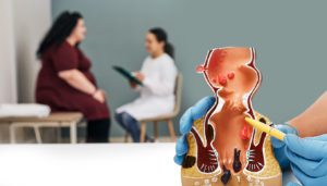 A primary care physician meeting with her patient to discuss the preparation needed for colorectal surgery. In the foreground there is an anatomical model of a digestive system.