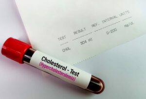 Blood sample with abnormal high report of Cholesterol test