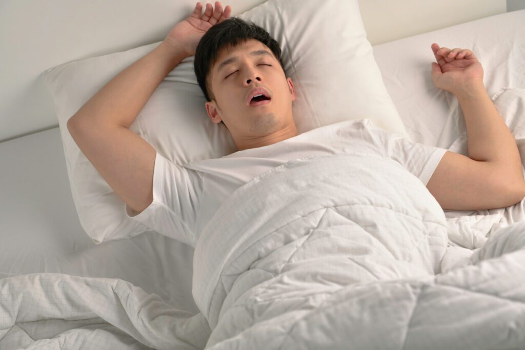 A man is sleeping in bed and snoring loudly due to sleep apnea.