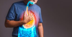 A man is experiencing heartburn as a result of gastroesophageal reflux disease (GERD).